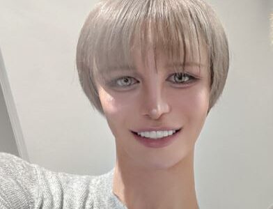 Mattの整形前の顔がイケメン！昔の画像と現在を比較して変化を検証