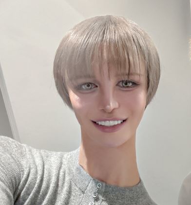 Mattの整形前の顔がイケメン！昔の画像と現在を比較して変化を検証