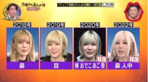 多田さんの整形前の顔は?現在の顔との変化を徹底比較! - うさぎエンタメブログ